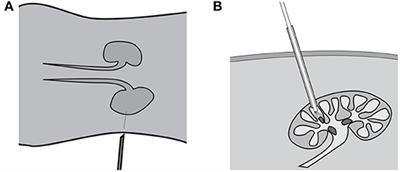 Evaluation of a Virtual Reality Percutaneous Nephrolithotomy (PCNL) Surgical Simulator